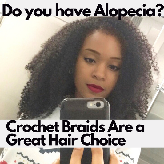 Do you Have Alopecia Crochet Braids Are a Great Choice