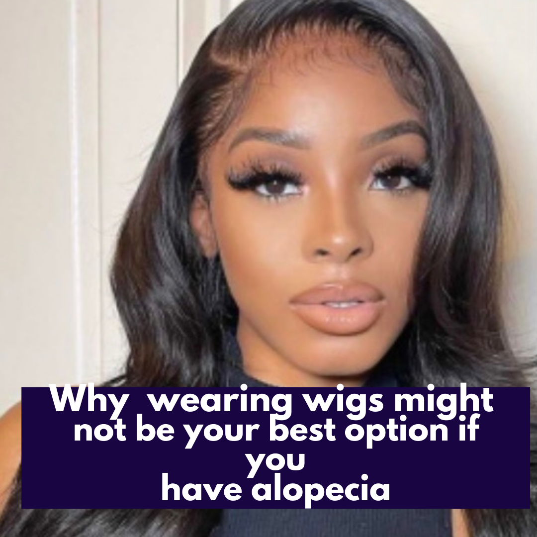 Why Wearing Wigs Might Not Be The Best Option If You Have Alopecia