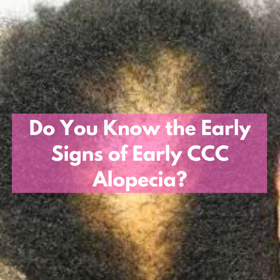 Do you know the Early Signs of Central Centrifugal Cicatricial Alopecia (CCCA)?